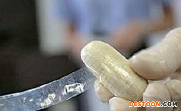 女子體內(nèi)運毒被捕